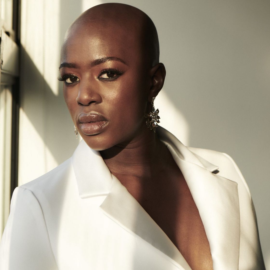 Hair loss: Jennifer Saayeng on her journey with alopecia