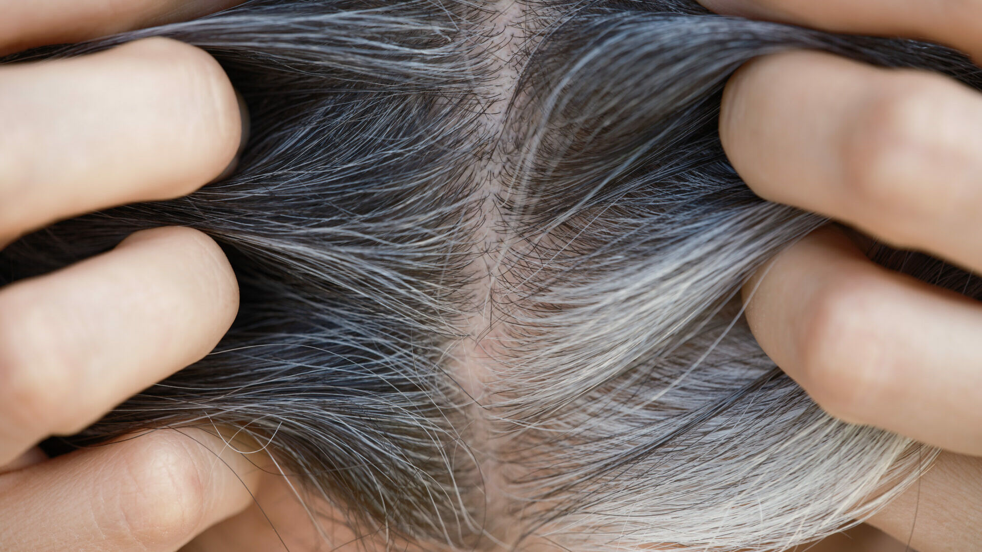 Can stress turn your hair grey? A trichologist explains